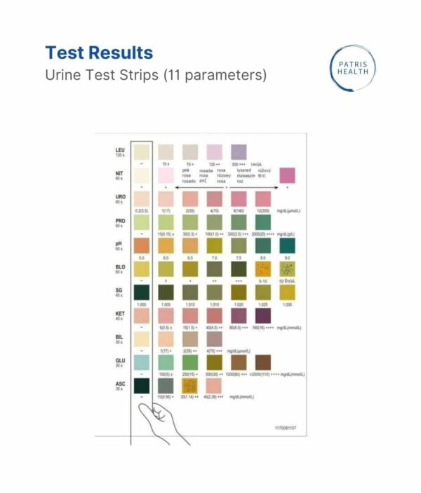 Colour card for the urine analysis results