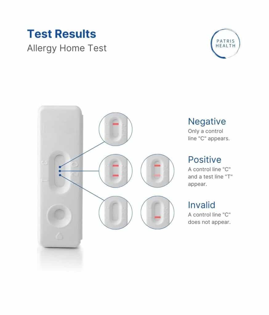 Possible results of the Patris Health® Allergy Home Test.