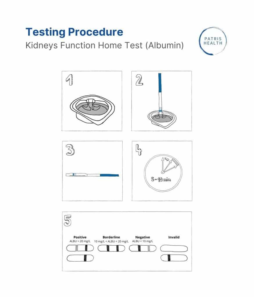 Patris Health - Kidneys Function Home Test (Albumin) - Testing procedure