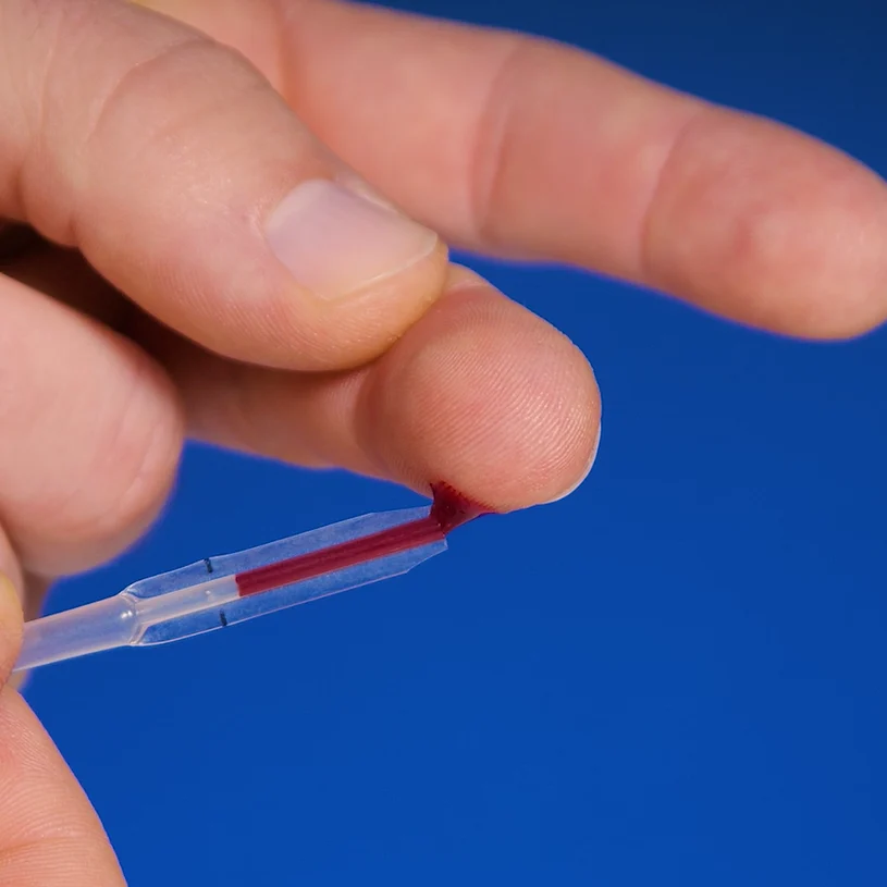 Patris Health Thyroid Function Home Test – step 2, drawing a drop of blood from the fingertip with the pipette