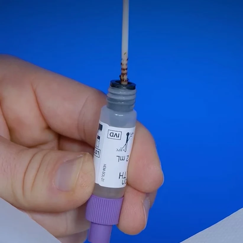 Patris Health Calprotectin Home Test – step 2, collection stick put back into the vial with the extraction solution