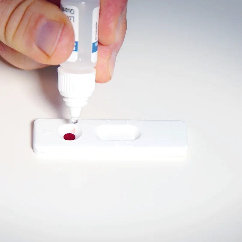 Patris Health Thyroid Function Home Test – step 4, adding four drops of diluent to the sample well